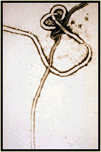 Ebola Virus