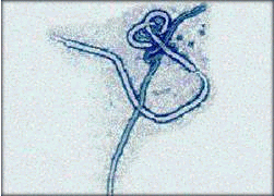 Ebola Virus